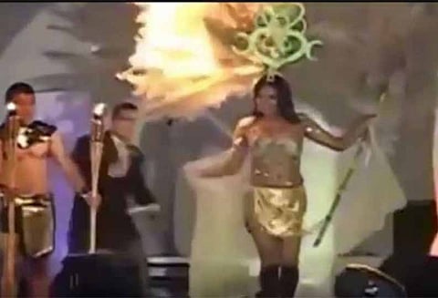 பேஷன் ஷோ நிகழ்ச்சியில், மாடல் அழகியின் ஆடையில் தீ பிடித்து விபத்து