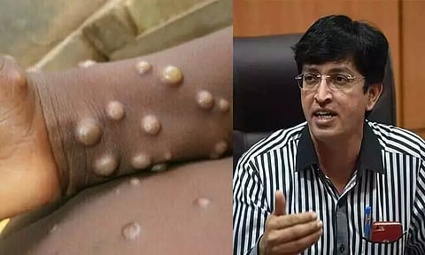 இந்தியாவில் குரங்கு காய்ச்சல் பாதிப்பு இல்லை; மக்கள் நல்வாழ்வுத்துறை செயலாளர் டாக்டர் ராதாகிருஷ்ணன் தகவல்