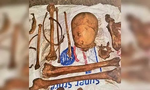 குப்பை தொட்டியில் மனித எலும்பு கூடு கிடந்ததால் பரபரப்பு - போலீசார் கைப்பற்றி விசாரணை