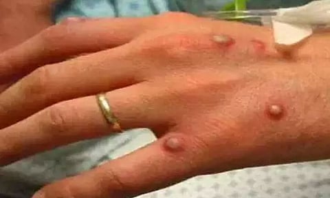 கோப்புப்படம்