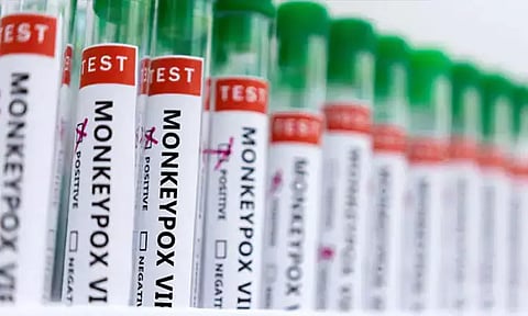 இந்தோனேஷியாவில் முதல் முறையாக ஒருவருக்கு குரங்கு அம்மை பாதிப்பு