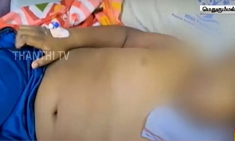 ஆசிட் கலந்த குளிர்பானத்தை குடித்த பள்ளி மாணவனின் 2 சிறுநீரகங்களும் செயலிழப்பு..!