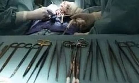 பெண்ணின் வயிற்றில் 5 ஆண்டாக இருந்த கத்தரிக்கோல்: விசாரணைக்கு உத்தரவு