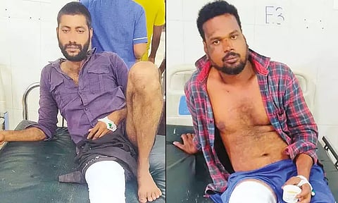 ஆஸ்பத்திரிக்குள் புகுந்து பெயிண்டர் கொலை: போலீஸ் பிடியில் இருந்து தப்பி ஓடிய 2 ரவுடிகளின் கால் முறிந்தது