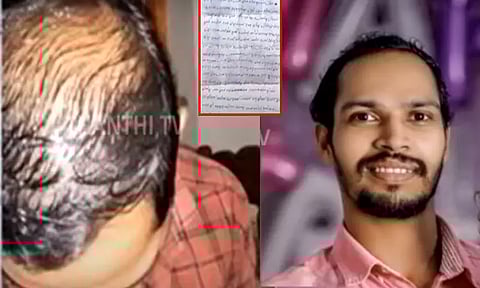 தலைமுடி கொட்டியதால் பெண் கிடைக்கவில்லை...இளைஞர் தூக்கிட்டு தற்கொலை - அதிர்ச்சி சம்பவம்