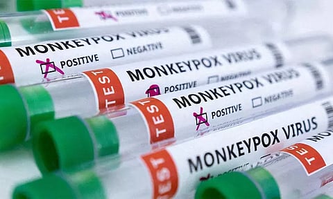 குரங்கம்மை இனி எம். பாக்ஸ் என அழைக்க உலக சுகாதார அமைப்பு முடிவு