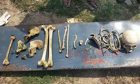 திருப்பரங்குன்றம் அருகே கண்மாய்க்குள் கிடந்த மண்டை ஓடு, எலும்புகள் - போலீசார் விசாரணை