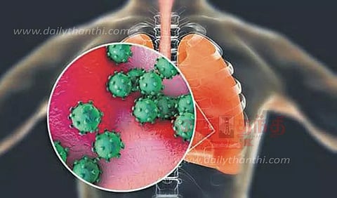 வேகமாக பரவும் வைரஸ் காய்ச்சல்