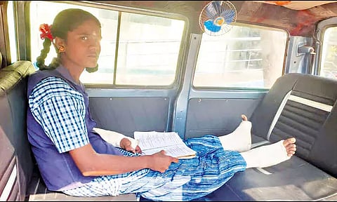 மாடிப்படியில் இருந்து விழுந்ததில் எலும்பு முறிவு: கை, கால்களில் போடப்பட்ட கட்டுடன் தேர்வு எழுதிய மாணவி
