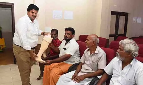 மாற்றுத்திறனாளிகளுக்கு செயற்கை கால்கள் வழங்கல்