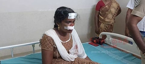 திருவட்டாரில் பட்டப்பகலில் துணிகரம்: ஸ்கூட்டரில் சென்ற பெண்ணை தாக்கி 7 பவுன் சங்கிலி பறிப்பு