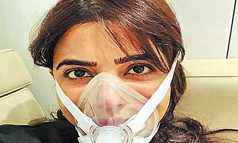 செயற்கை சுவாச கருவியுடன் நடிகை சமந்தாவுக்கு மீண்டும் சிகிச்சை - ரசிகர்கள் அதிர்ச்சி