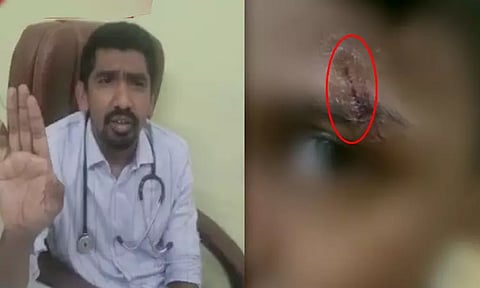 தலையில் அடிப்பட்ட சிறுவனுக்கு தையல் போடாமல் பெவிக்குவிக் தடவிய மருத்துவர்.! - தெலங்கானாவில் அதிர்ச்சி