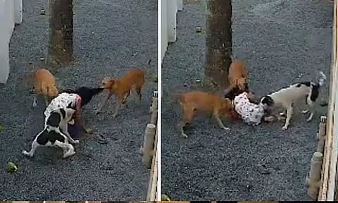 தெருநாய்கள் தாக்கியதில் 9 வயது சிறுமி பலத்த காயம்