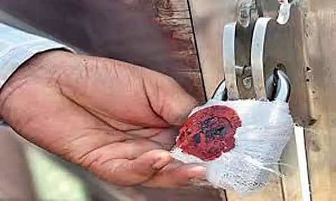 சுரண்டை, சேர்ந்தமரத்தில் 2 நகை அடகு கடைகளுக்கு சீல் வைப்பு