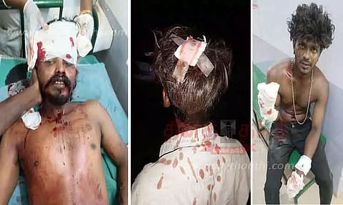 இருதரப்பினர் பயங்கர மோதல்; 5 பேருக்கு அரிவாள் வெட்டு