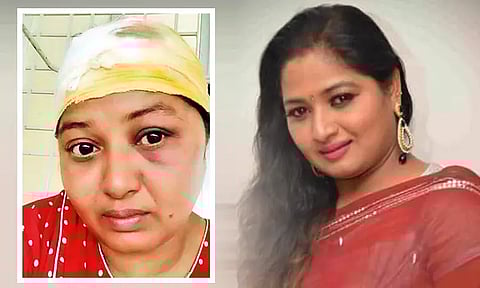 நிலத்தகராறில் நடிகை மீது தாக்குதல்