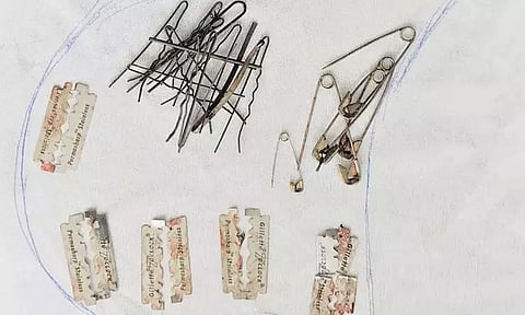 மனநலம் பாதித்த இளைஞர் வயிற்றில் இருந்த ஹேர்பின், பிளேடு, ஊக்குகள் - எண்டோஸ்கோபிக் கருவி மூலம் அகற்றிய மருத்துவர்கள்