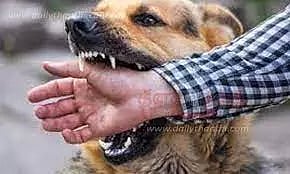 நாய் கடித்ததில் குழந்தை உள்பட 3 பேர் காயம்