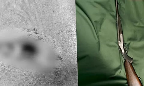 சென்னை சேத்துப்பட்டில், ஏ.டி.எம். மைய காவலாளி துப்பாக்கி குண்டு பாய்ந்து காயம்..!