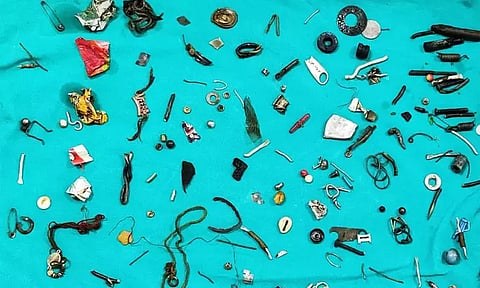 தீராத வயிற்று வலியால் அவதிப்பட்ட மனநோயாளி.. ஆபரேசன் செய்தபோது காத்திருந்த அதிர்ச்சி