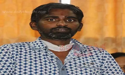 வாலிபரின் அரிய வகை நோய்க்கு சிகிச்சை அளித்து டாக்டர்கள் சாதனை