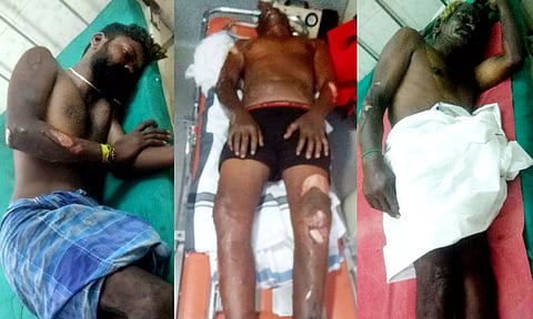 'சார்ஜ்' போடப்பட்டிருந்த செல்போன் வெடித்து சிதறியதில் 3 பேர் படுகாயம்