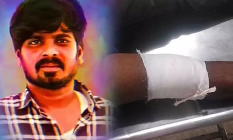 தப்பி செல்ல முயன்ற ரவுடியை சுட்டு பிடித்த போலீசார்..!