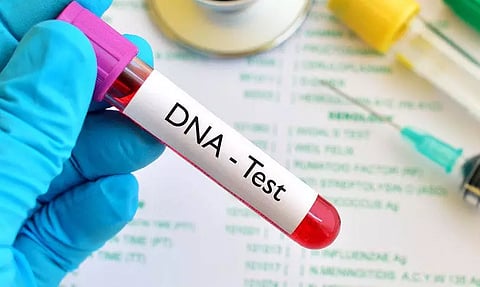 மேலும் 5 பேரிடம்டி.என்.ஏ. பரிசோதனை