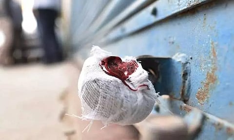 விதிமீறிய 2 உர கடைகளுக்கு 'சீல்'