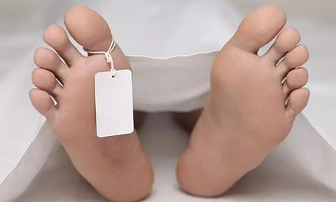 அம்மை நோயால் பாதிக்கப்பட்ட சிறுவன் சாவு