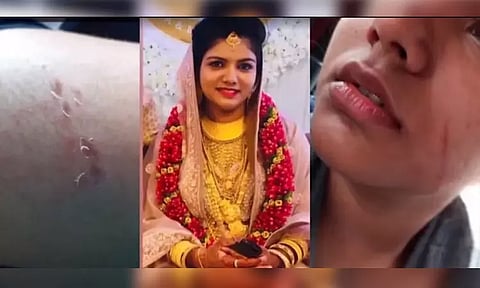 75 சவரன் நகை கொடுத்தும் கூடுதல் வரதட்சணை கேட்டு துன்புறுத்தல்: பெண் தூக்கிட்டு தற்கொலை