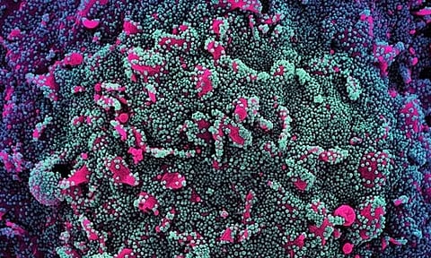 கோவையில் ஒருவருக்கு ஜே.என்.1 கொரோனா பாதிப்பு