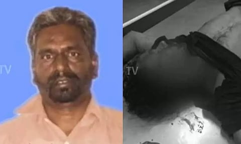 தமிழ் பழக்க வழக்கங்கள் குறித்து கிண்டல் - வடமாநில இளைஞருக்கு கத்திக்குத்து