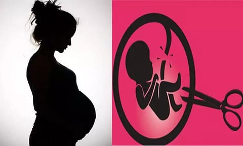 74 கருக்கலைப்பு சம்பவங்கள்: தனியார் ஆஸ்பத்திரி மீது வழக்கு - சுகாதார துறை அதிரடி