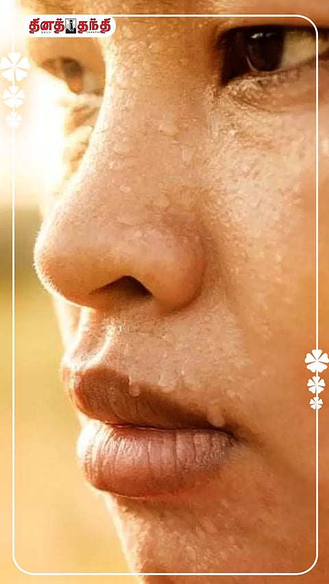 முகத்தில் அதிகம் வியர்க்க காரணம் தெரியுமா?