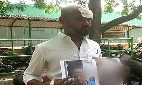 நோயாளியின் தலைக்குள் துணியை வைத்து தைத்த அவலம் - தனியார் மருத்துவமனை மீது குற்றச்சாட்டு