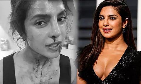 Priyanka Chopra's Injured While Doing Stunts; Worried Fans Send Wishes