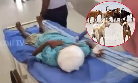 நடந்து சென்ற சிறுமியை கடித்து குதறிய தெரு நாய்கள்.. அதிர்ச்சி சம்பவம்