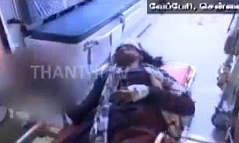 சென்னை: மொபட்டில் இருந்து கீழே விழுந்த இளம்பெண்.. உள்ளங்கையை துளைத்த கம்பி