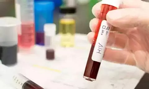 பள்ளி, கல்லூரி மாணவர்களுக்கு எய்ட்ஸ்