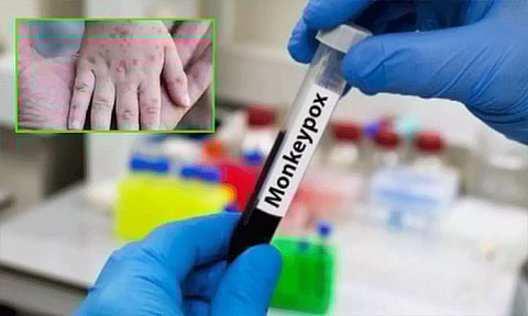 கோப்புப்படம் 