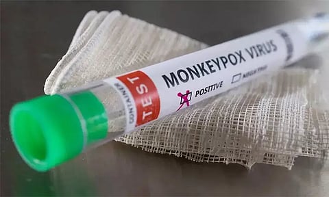 பாகிஸ்தானில் 3 பேருக்கு குரங்கு அம்மை பாதிப்பு