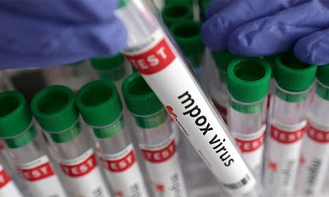 கேரளாவில் ஒருவருக்கு குரங்கம்மை தொற்று உறுதி