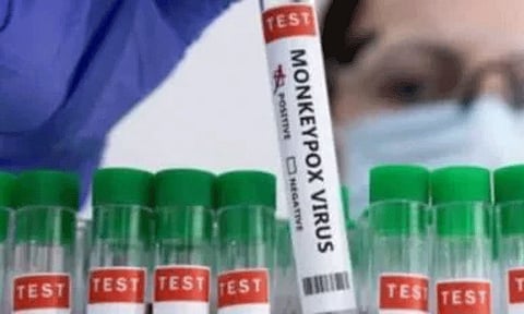 கோப்புப்படம்