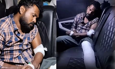 மாணவி பாலியல் வன்கொடுமை வழக்கில் கைதான ஞானசேகரன் மருத்துவமனையில் அனுமதி