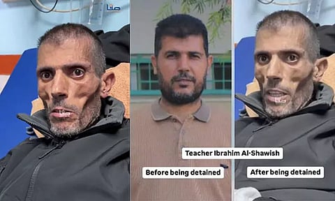 விவரிக்க முடியாத அளவுக்கு பாலஸ்தீனிய கைதியின் நிலை; வைரலான வீடியோ