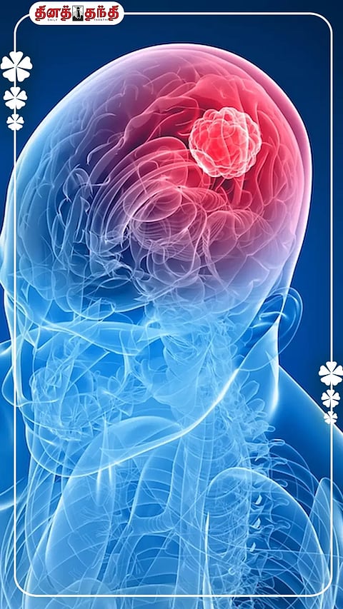 இந்த பழக்கங்களை தவிர்த்தால் மூளை பாதிப்பை குறைக்கலாம்..!