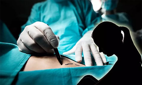 கொழுப்பு நீக்க அறுவை சிகிச்சை: கையில் 4 விரல்கள், காலில் 5 விரல்களை இழந்த பெண் என்ஜினீயர்