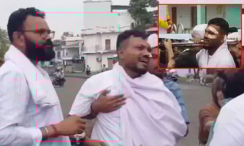 ஏர் இந்தியா விமான விபத்து; உயிர் தப்பியவர் காயங்களுடன் சகோதரர் உடலை தூக்கி சென்ற சோகம்